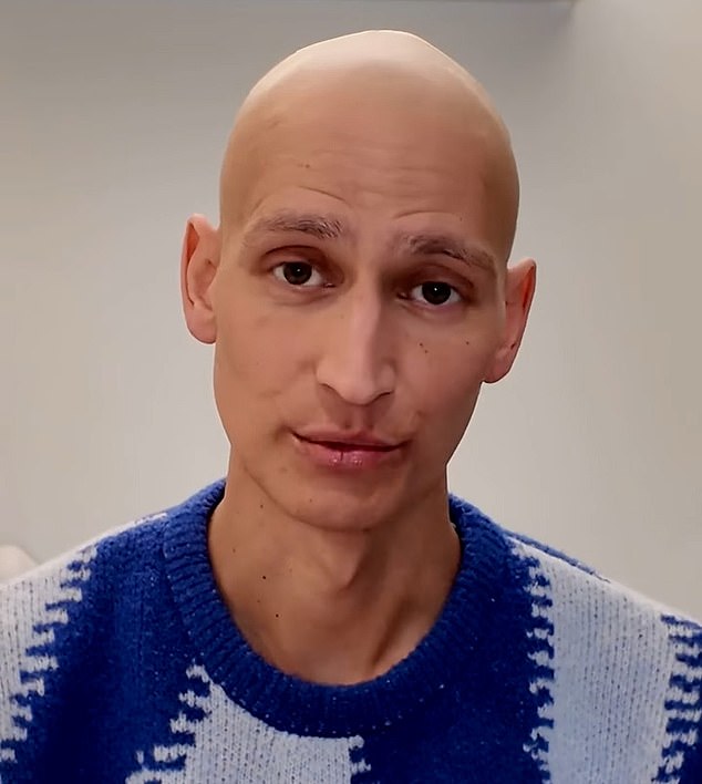 The top model now runs his own Instagram account which documents his 'journey' with cancer