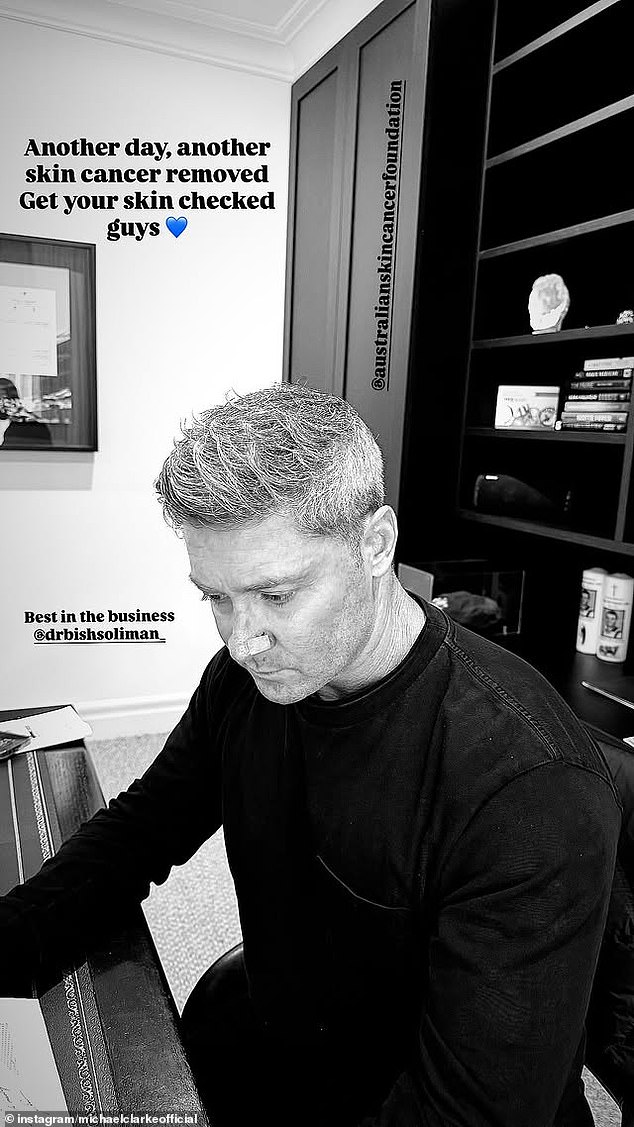 The former Australian cricket captain revealed on The Kyle and Jackie O Show that he's had multiple melanomas removed from his face and body over the years