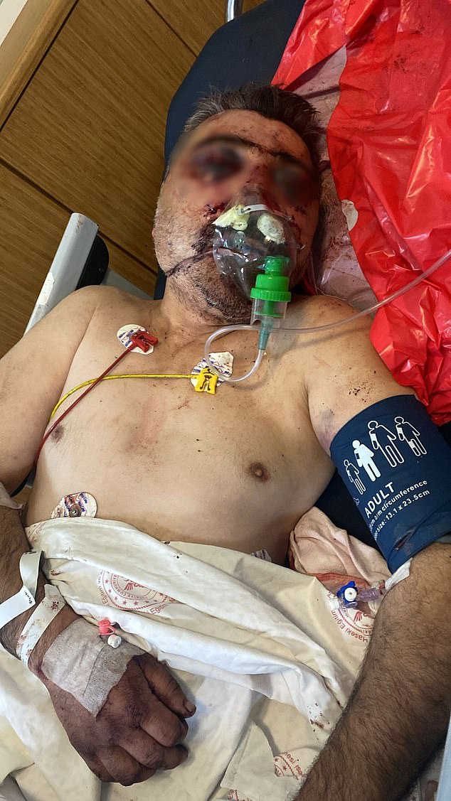 Driver Kadir Bicer was left in a coma after allegedly being attacked in his car on April 25