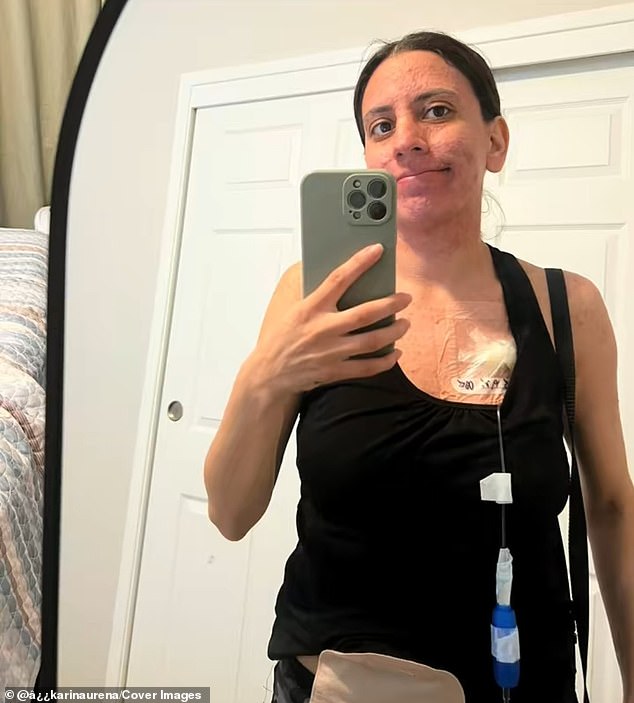 Ureña is pictured above during her cancer treatment. She remains hopeful that she will beat the cancer