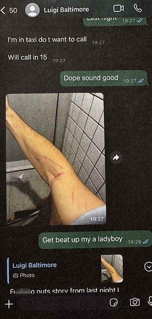 The unnamed friend shared text messages from the accused killer who sent photos of his injuries