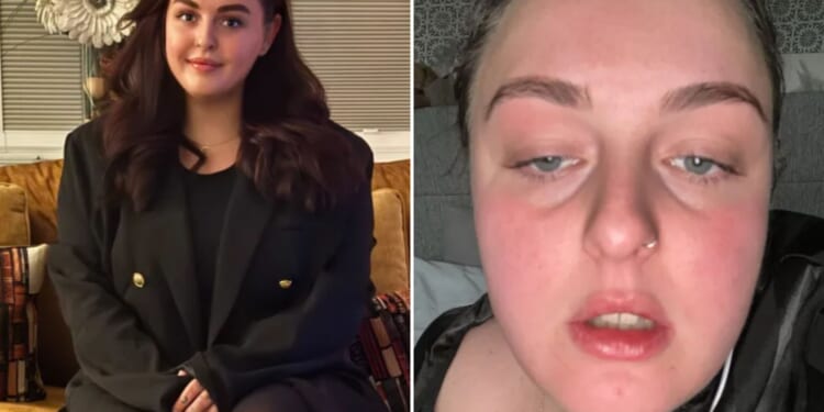 I blew benefits on coke addiction…it was so bad, I'd lick car seat & sniff carpet if I dropped drugs before wake-up call