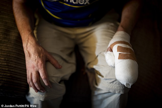 Mr Crean said: 'I got caught on my fingers. He took a swing at this, and a swing at that. I got caught on the head'