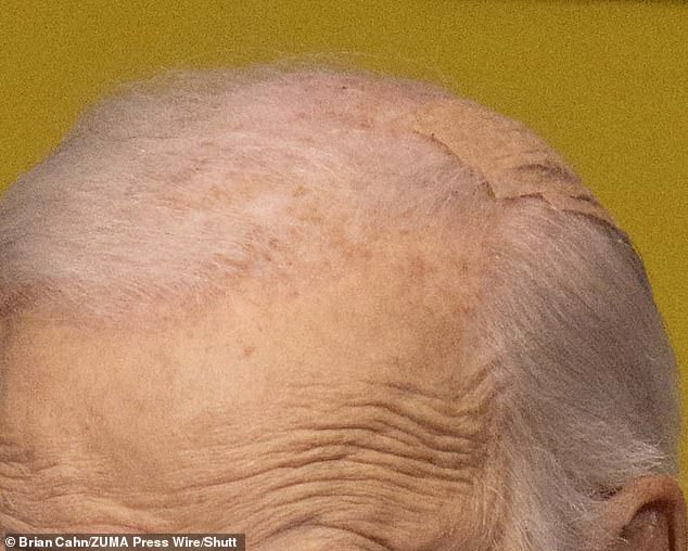 He had a smaller bandage on his head as he spoke in Nebraska on Friday