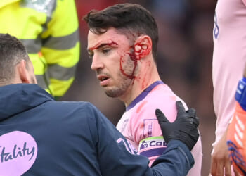 Adam Smith health update after Bournemouth star's face left covered in blood following collision with team-mate