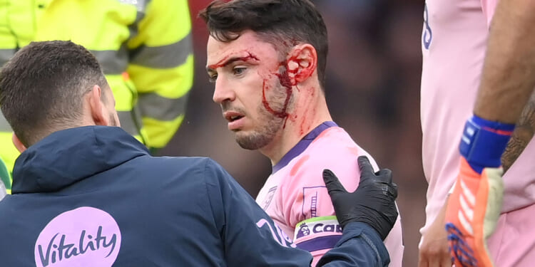 Adam Smith health update after Bournemouth star's face left covered in blood following collision with team-mate