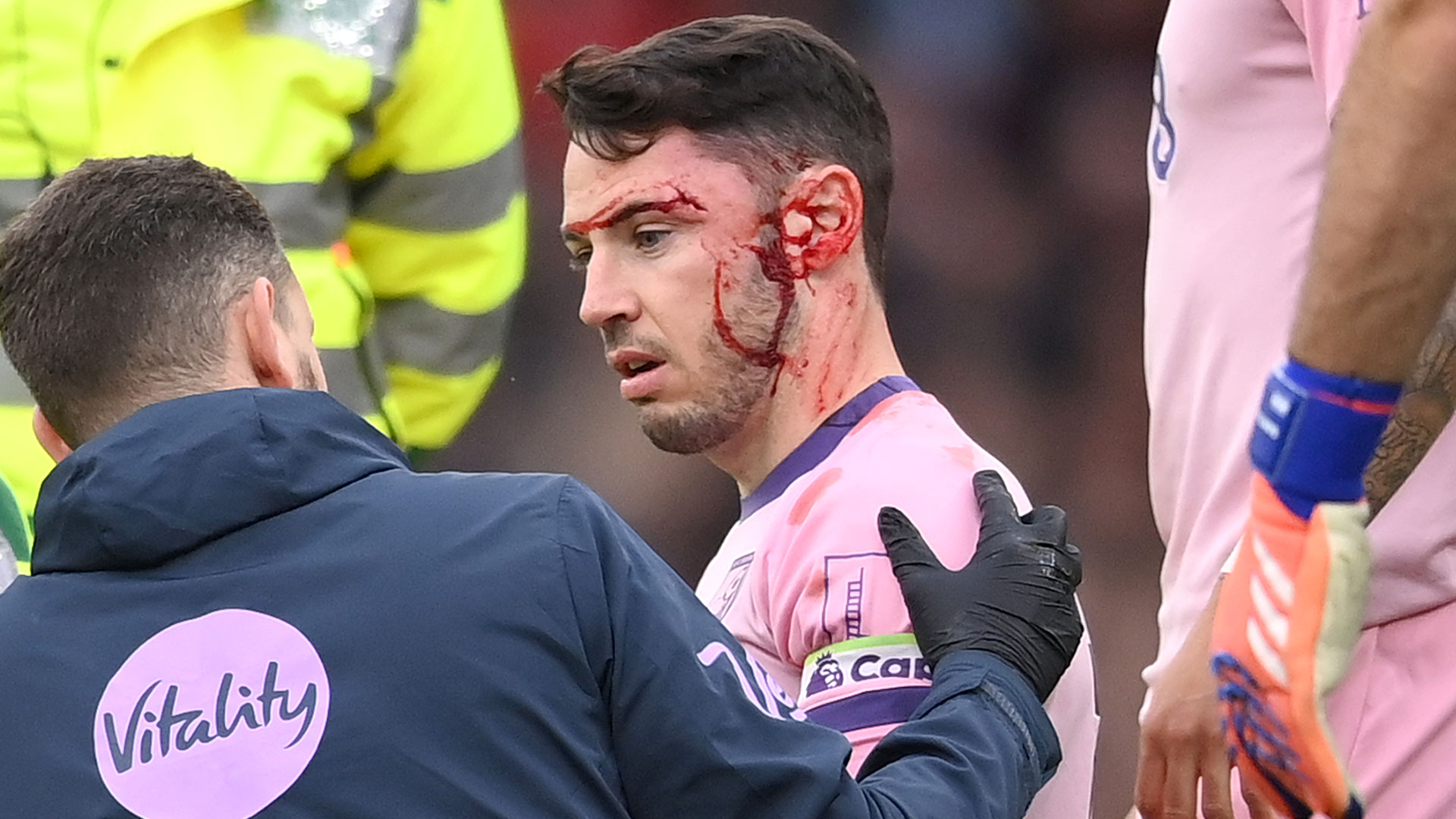 Adam Smith health update after Bournemouth star's face left covered in blood following collision with team-mate