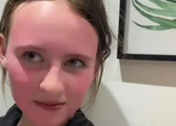 My 11-year-old was left with a dyed face that wouldn’t wash off after using a £1.33 Home Bargains buy at a sleepover
