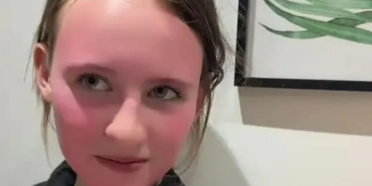 My 11-year-old was left with a dyed face that wouldn’t wash off after using a £1.33 Home Bargains buy at a sleepover