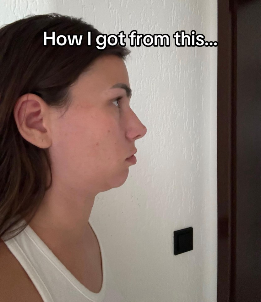 A woman's profile showing a double chin, with the text "How I got from this..."