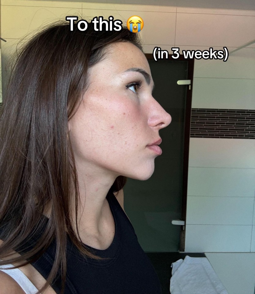 Profile view of a woman with long dark hair and clear skin, wearing a black top. Text overlay reads "To this" with a crying emoji and "(in 3 weeks)".