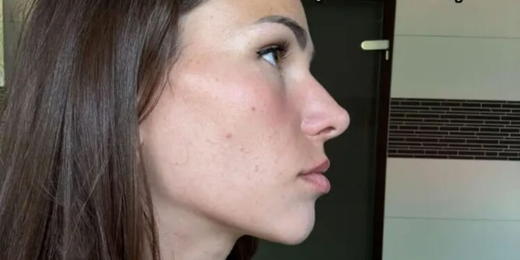 People ask if I got surgery to fix my sagging chin