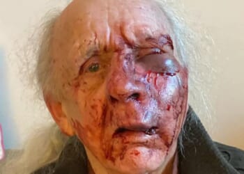 OAP suffers horror injuries after 'psycho' neighbour left him for dead in random street attack outside their homes