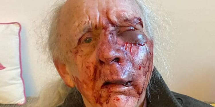 OAP suffers horror injuries after 'psycho' neighbour left him for dead in random street attack outside their homes