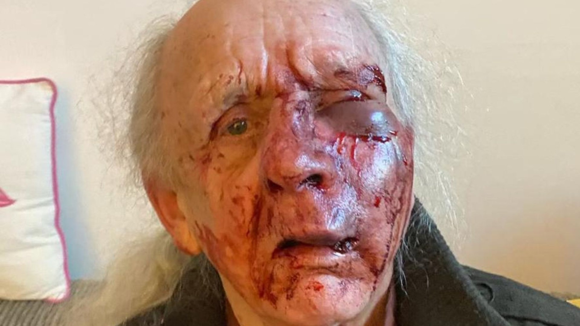OAP suffers horror injuries after 'psycho' neighbour left him for dead in random street attack outside their homes