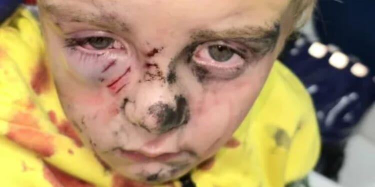 Boy, 5, mauled by dog in park in front of horrified mum ‘who was sure it would kill him’