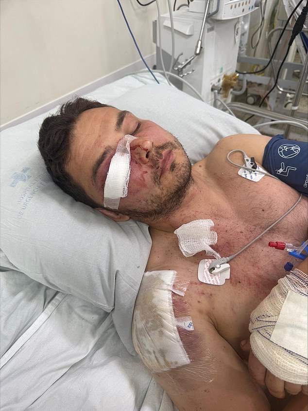 He suffered multiple severe injuries, including a fractured eye socket, broken nose, brain contusion, fractured shoulder blade, broken ribs, a bruised lung, and extensive tissue damage