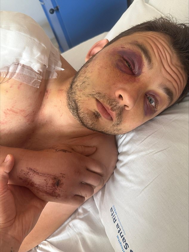 He later revealed the devastating toll of the incident, saying he was left with double vision, slow, foggy thinking, and had lost most of his old memories