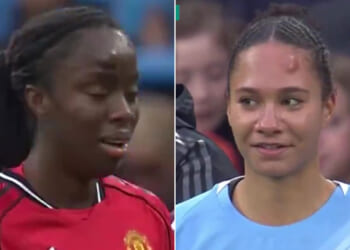 Man Utd and Man City women's stars left with huge lumps on foreheads after brutal head clash during derby