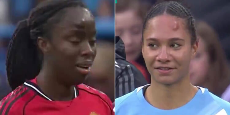 Man Utd and Man City women's stars left with huge lumps on foreheads after brutal head clash during derby