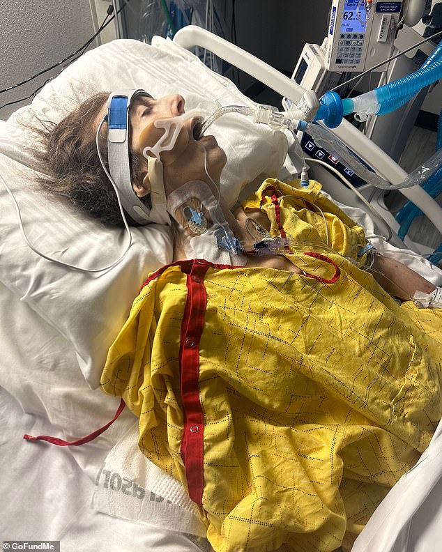 Tonja underwent four grueling procedures while she was hospitalized