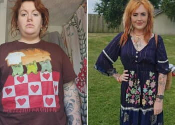 I lost 9st on Mounjaro after strangers thought I was pregnant