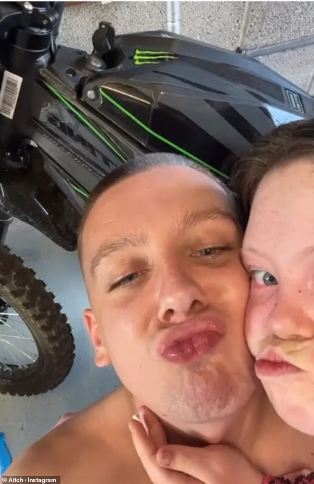 Down syndrome is a condition in which a person has an extra chromosome