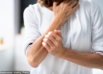 One cause of itchiness is scabies - an infestation of mites in the skin that can be incredibly itchy and may not have an obvious rash