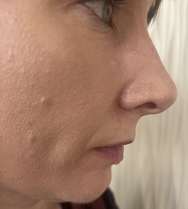 My skin after I finally found the correct products to treat my condition