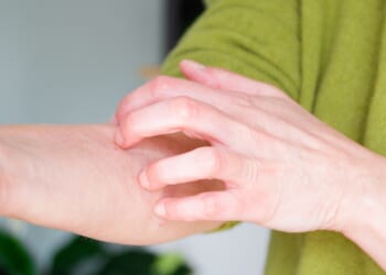 The easy-to-ignore symptom of one of the UK's deadliest cancers you might blame on the freezing temperatures