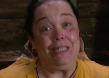 I'm a Celebrity's Lisa Riley sparks concern as viewers notice troubling change