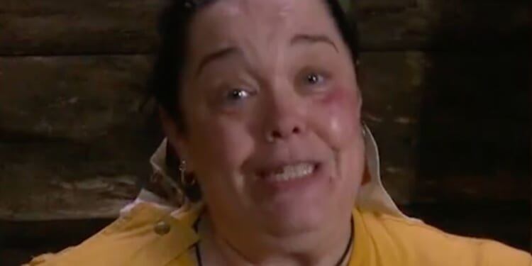 I'm a Celebrity's Lisa Riley sparks concern as viewers notice troubling change