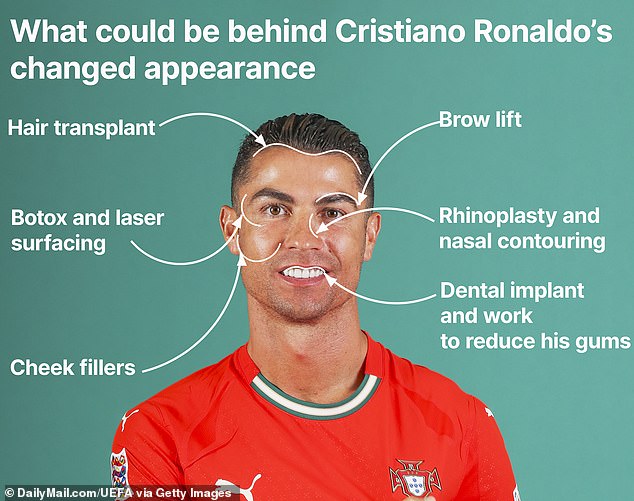 Ronaldo's alleged cosmetic surgery procedures, according to Dr. Elie Levine (Ronaldo pictures in June this year)