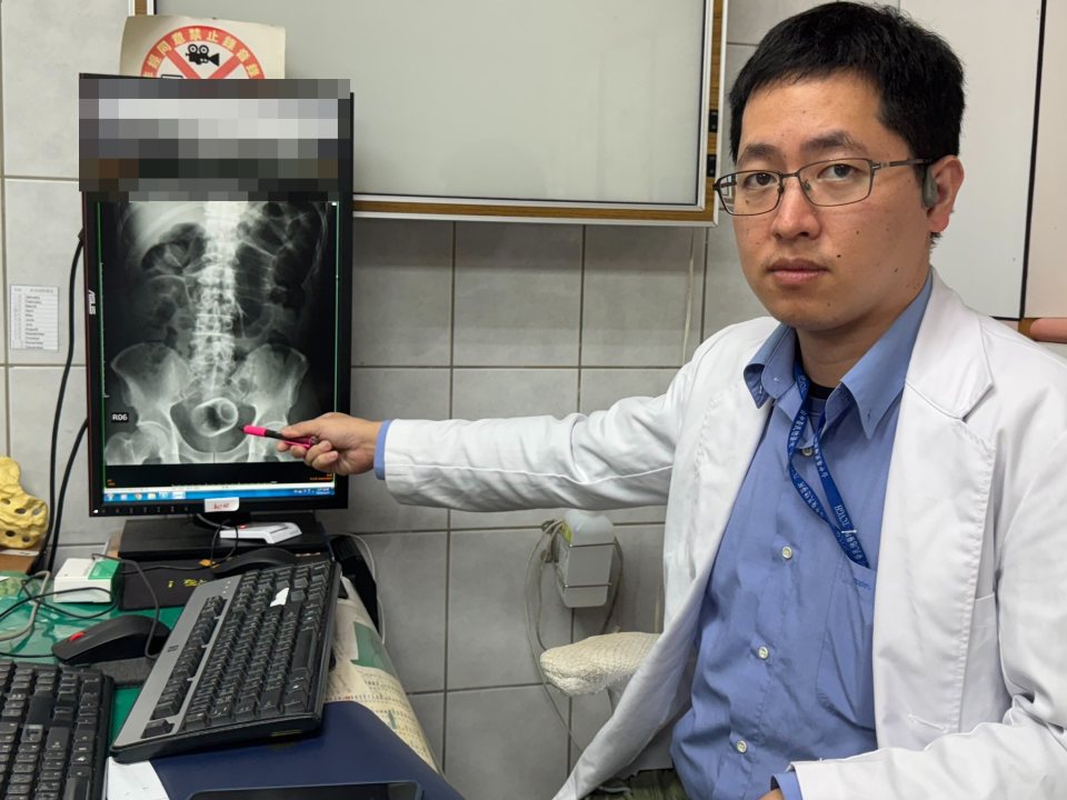 Brew dunnit! Teacup found lodged in constipated man¿s bum leaves doctors stunned