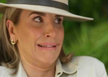 Vogue Williams reveals the cosmetic work she's had done before arriving in I'm A Celebrity