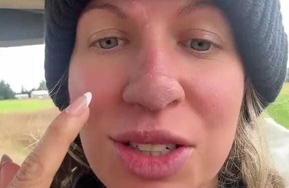 My dog of 11 years ripped the tip of my nose off without any warning