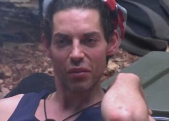 I'm A Celeb's Tom Read Wilson reveals real voice in shock moment