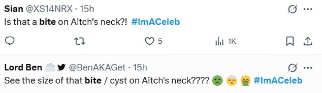 Many have taken to X, formerly known as Twitter, to point out loads of marks on the star's bodies