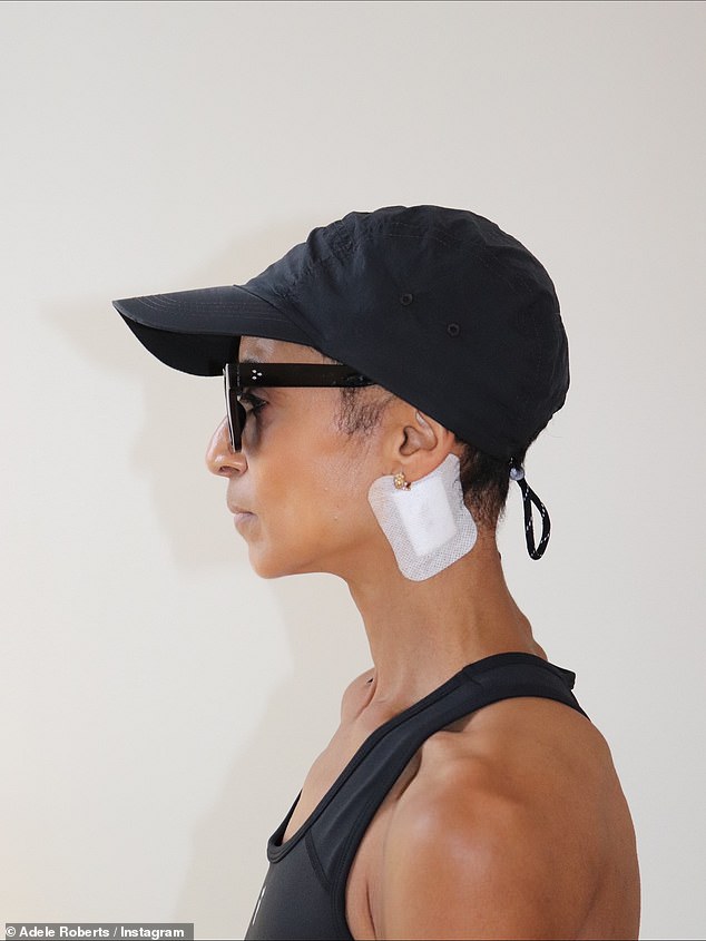 The radio presenter, 46, revealed she has had a second cancer scare as she showed off a scar behind her ear following having a lump removed