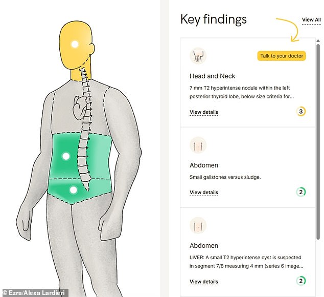 I have a very small nodule on my thyroid but it is not big enough to be concerned about. Dr Hyman said to follow up with an endocrinologist for an ultrasound, but it doesn't require imminent medical attention
