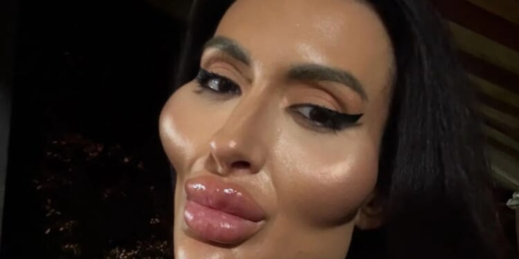Woman with 'world's biggest cheeks' shares rare snap before extreme filler & folk are stunned at how ‘beautiful’ she was