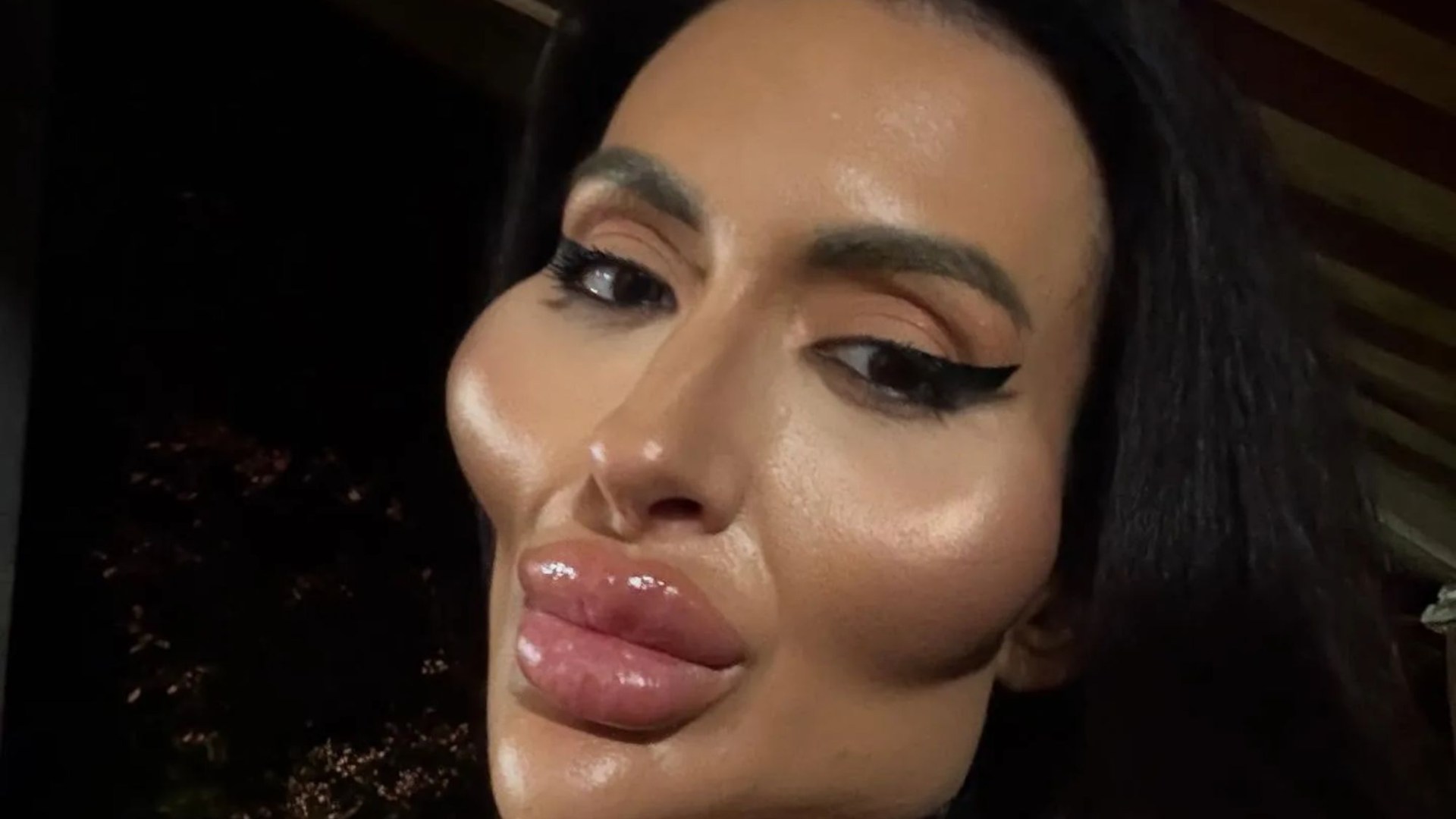 Woman with 'world's biggest cheeks' shares rare snap before extreme filler & folk are stunned at how ‘beautiful’ she was