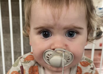 Baby Ava’s eye changed when she caught a bug