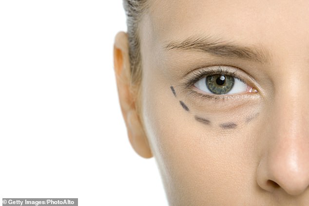 Some eye procedures work better than Botox at making you look younger