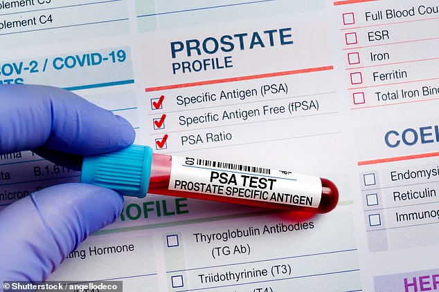 Kenny, from Dunblane, explained that three of his uncles had the disease leading him to push for regular, three-monthly tests. Pictured: The NHS currently uses PSA (prostate specific antigen) blood testing and MRI scans to check for the disease (file image)