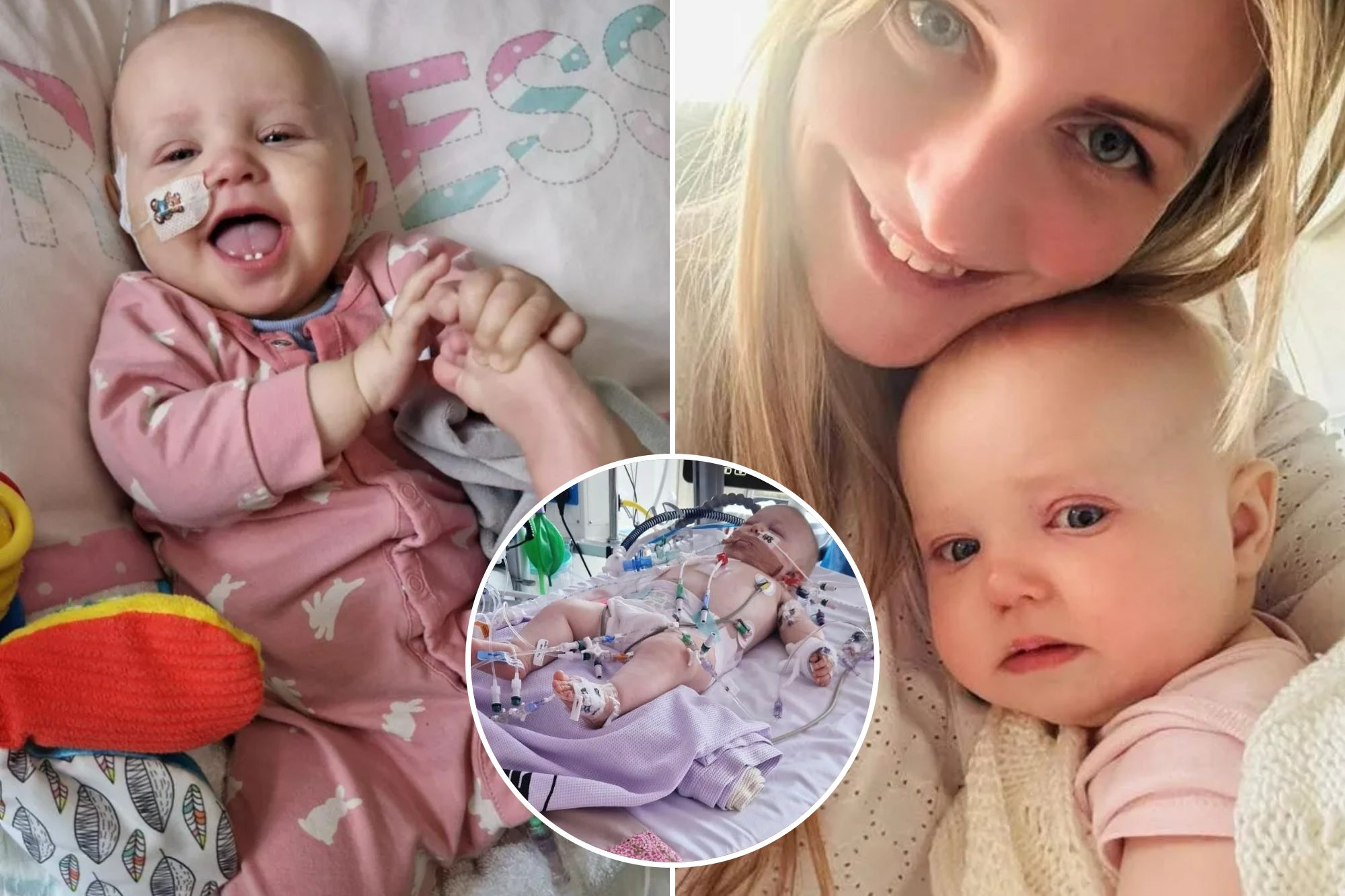 An image collage containing 3 images, Image 1 shows Baby Melody with a nasal cannula and a nasogastric tube, smiling and holding her foot, Image 2 shows A smiling woman in a white top holding an 11-month-old baby with cancer, Image 3 shows An infant with tubes and wires connected to medical equipment in a hospital bed