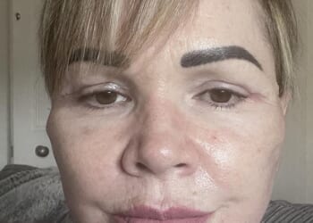 Angela Paterson, 48, saved up for two years and spent over £8,000 on a facelift , necklift and upper blepharoplasty in Kaunas, including flights, accommodation and pet-sitting costs