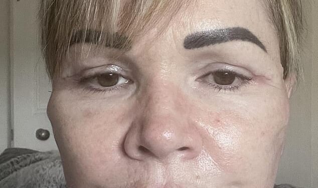 Angela Paterson, 48, saved up for two years and spent over £8,000 on a facelift , necklift and upper blepharoplasty in Kaunas, including flights, accommodation and pet-sitting costs
