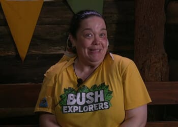 Lisa Riley sparked concern among I'm A Celebrity...Get Me Out Of Here! Viewers on Thursday evening after they noticed a surprising change in her appearance