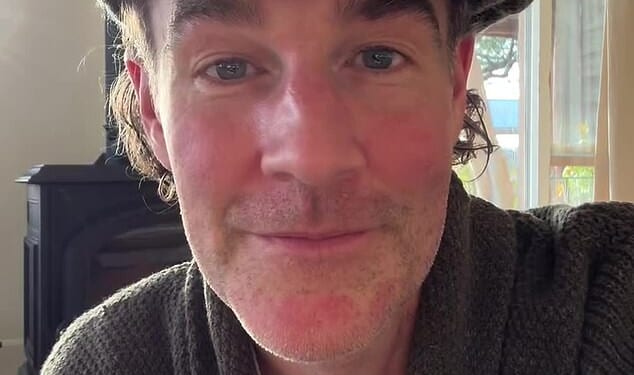 James Van Der Beek, 48, is putting a number of his cherished Dawson's Creek keepsakes on auction to help pay for his 'expensive' cancer treatments